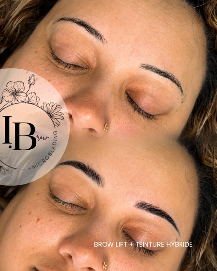 Avant / après brow lift avec teinture hybride : un sourcil redessiné, plus dense et remonté vers la tempe.