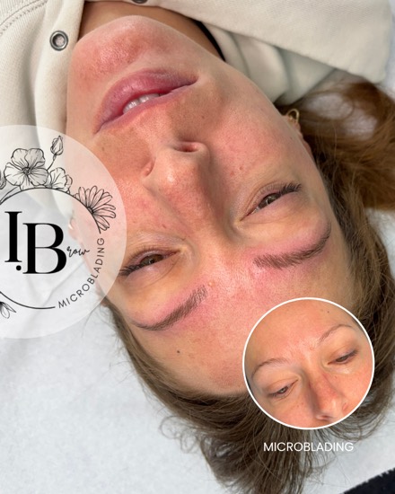 Résultat microblading : sourcils clairsemés redensifiés poil par poil, avant en médaillon.
